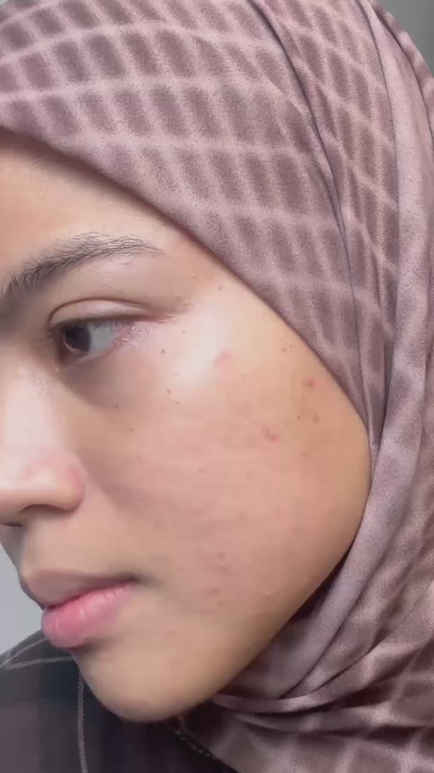 Ginsenoside Rare Siang Dan Malam Pembaikan Ganda Pati Menghilangkan Jerawat